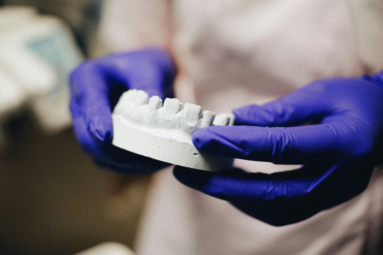 A dental professional holding a model of prepared teeth