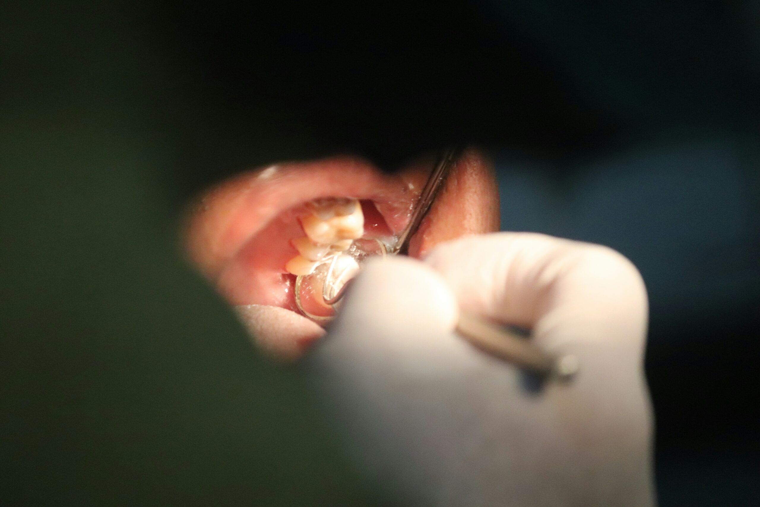 A close-up view of a dental examination