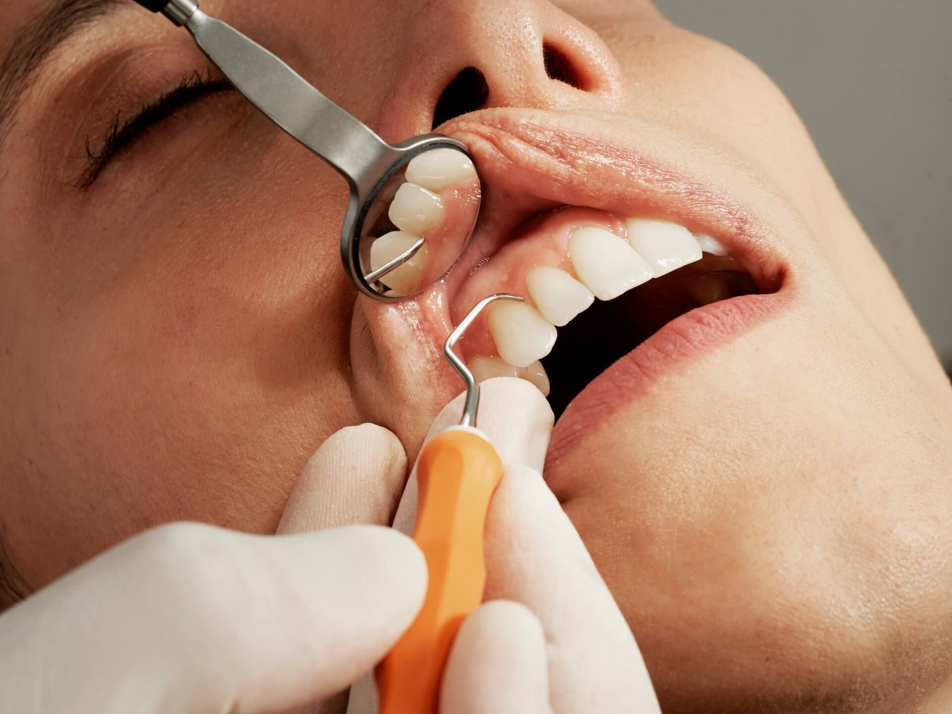 A dental professional examining a patient’s gums